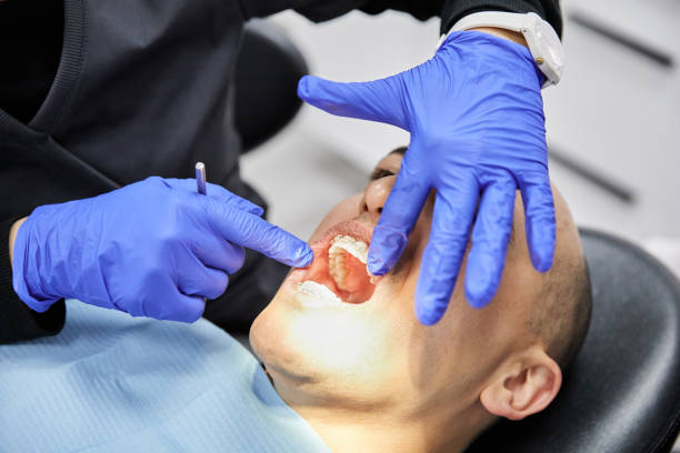 Best Broken or Chipped Tooth Repair in Kiawah Island, SC